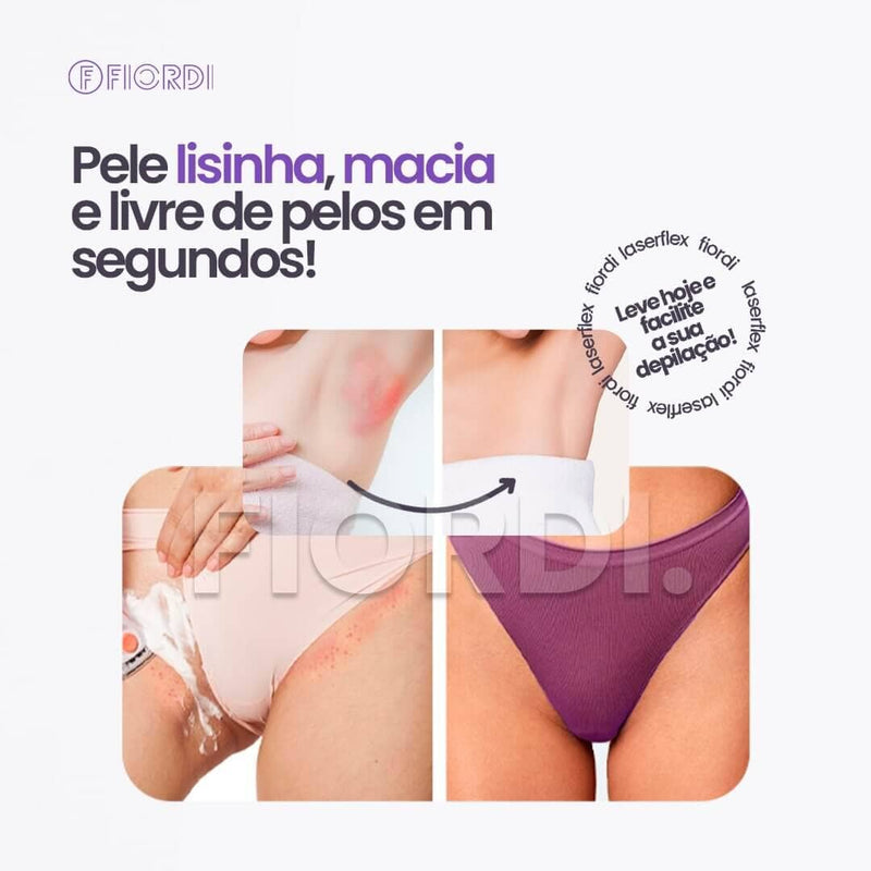 Depilador Laser Indolor 2 em 1 [FRETE GRÁTIS]